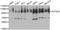 ATPase Sarcoplasmic/Endoplasmic Reticulum Ca2+ Transporting 2 antibody, STJ22718, St John