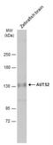 Activator Of Transcription And Developmental Regulator AUTS2 antibody, NBP1-32784, Novus Biologicals, Western Blot image 
