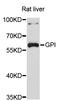 Glucose-6-Phosphate Isomerase antibody, STJ23840, St John
