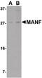 Mesencephalic Astrocyte Derived Neurotrophic Factor antibody, PA5-20432, Invitrogen Antibodies, Western Blot image 