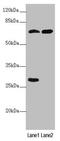 Protein Phosphatase 2 Regulatory Subunit B''Beta antibody, LS-C676302, Lifespan Biosciences, Western Blot image 