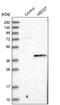 Mediator Complex Subunit 27 antibody, PA5-52374, Invitrogen Antibodies, Western Blot image 