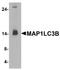 Microtubule Associated Protein 1 Light Chain 3 Beta antibody, A01524, Boster Biological Technology, Western Blot image 