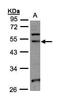 NOP2/Sun RNA Methyltransferase 6 antibody, PA5-21823, Invitrogen Antibodies, Western Blot image 