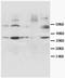 Cyclin D1 antibody, AM20616PU-N, Origene, Western Blot image 