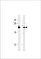 Family With Sequence Similarity 216 Member B antibody, TA325011, Origene, Western Blot image 