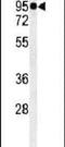 Macoilin 1 antibody, PA5-24873, Invitrogen Antibodies, Western Blot image 