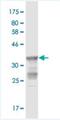 Steroidogenic Acute Regulatory Protein antibody, H00006770-M10, Novus Biologicals, Western Blot image 
