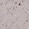 Kelch Domain Containing 3 antibody, HPA030132, Atlas Antibodies, Immunohistochemistry paraffin image 