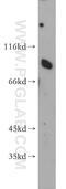 Scavenger Receptor Class B Member 1 antibody, 21277-1-AP, Proteintech Group, Western Blot image 