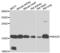 N(Alpha)-Acetyltransferase 20, NatB Catalytic Subunit antibody, PA5-77135, Invitrogen Antibodies, Western Blot image 