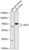 Glypican 3 antibody, 15-307, ProSci, Western Blot image 