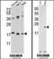 Cofilin 1 antibody, MBS9203261, MyBioSource, Western Blot image 