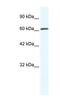 Zinc Finger MYM-Type Containing 6 antibody, NBP1-80053, Novus Biologicals, Western Blot image 