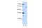Zinc Finger Protein 497 antibody, A17630, Boster Biological Technology, Western Blot image 