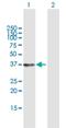 Small Glutamine Rich Tetratricopeptide Repeat Containing Beta antibody, H00054557-B01P, Novus Biologicals, Western Blot image 