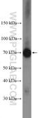 Protein arginine N-methyltransferase 5 antibody, 18436-1-AP, Proteintech Group, Western Blot image 