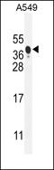 BCL2 Interacting Protein 3 Like antibody, MBS9206723, MyBioSource, Western Blot image 