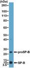 PSPB antibody, NBP2-77431, Novus Biologicals, Western Blot image 