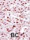 Casein Kinase 2 Alpha 1 antibody, 63-424, ProSci, Immunohistochemistry paraffin image 