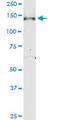 Nephrocystin 3 antibody, H00027031-M05, Novus Biologicals, Western Blot image 