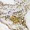 Interferon Induced With Helicase C Domain 1 antibody, STJ24125, St John