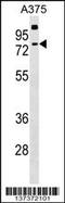 Transketolase Like 2 antibody, 59-143, ProSci, Western Blot image 