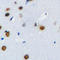 Polo Like Kinase 1 antibody, LS-C368472, Lifespan Biosciences, Immunohistochemistry paraffin image 