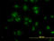 Transcription Factor 7 Like 2 antibody, LS-C105038, Lifespan Biosciences, Immunofluorescence image 