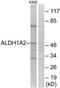 Aldehyde Dehydrogenase 1 Family Member A2 antibody, TA314820, Origene, Western Blot image 