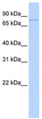 Zinc Finger And BTB Domain Containing 39 antibody, TA334224, Origene, Western Blot image 