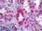 Prohibitin antibody, LS-B5415, Lifespan Biosciences, Immunohistochemistry paraffin image 