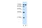 Ribonucleotide Reductase Catalytic Subunit M1 antibody, 30-137, ProSci, Western Blot image 