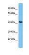 Matrix Metallopeptidase 14 antibody, orb76942, Biorbyt, Western Blot image 