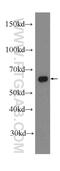 Apoptosis Inducing Factor Mitochondria Associated 1 antibody, 17984-1-AP, Proteintech Group, Western Blot image 