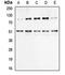 Nuclear Factor Kappa B Subunit 1 antibody, orb214307, Biorbyt, Western Blot image 