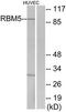 RNA Binding Motif Protein 5 antibody, TA315028, Origene, Western Blot image 