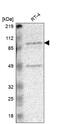 RPA1 Related Single Stranded DNA Binding Protein, X-Linked antibody, NBP1-83873, Novus Biologicals, Western Blot image 