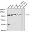 Complement C3d Receptor 2 antibody, GTX64400, GeneTex, Western Blot image 