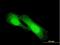 N-Myc Downstream Regulated 1 antibody, H00010397-M03, Novus Biologicals, Immunocytochemistry image 