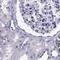 PCSK1 antibody, PA5-64180, Invitrogen Antibodies, Immunohistochemistry paraffin image 