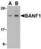 Barrier To Autointegration Factor 1 antibody, MBS150274, MyBioSource, Western Blot image 