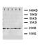 Fibroblast Growth Factor 10 antibody, LS-C312614, Lifespan Biosciences, Western Blot image 