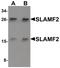 CD48 Molecule antibody, PA5-21134, Invitrogen Antibodies, Western Blot image 