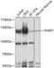 Poly(ADP-Ribose) Polymerase 1 antibody, 13-882, ProSci, Western Blot image 