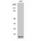 Cellular Retinoic Acid Binding Protein 2 antibody, LS-C382886, Lifespan Biosciences, Western Blot image 