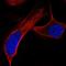 ATM Serine/Threonine Kinase antibody, HPA067142, Atlas Antibodies, Immunofluorescence image 