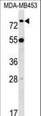 LIM Domain Binding 3 antibody, LS-C165728, Lifespan Biosciences, Western Blot image 