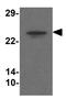 Transmembrane Protein 204 antibody, GTX32025, GeneTex, Western Blot image 