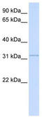 Sushi Domain Containing 4 antibody, TA342349, Origene, Western Blot image 